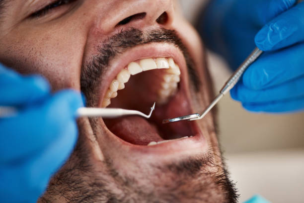 Best Emergency Dental Care for Broken or Chipped Teeth in Holdenville, OK